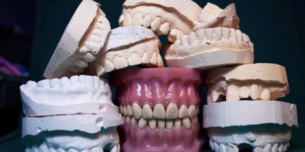 Dental insurance documents and forms on a desk, representing dental insurance coverage and claims