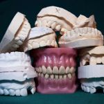 The Truth About Dental Insurance